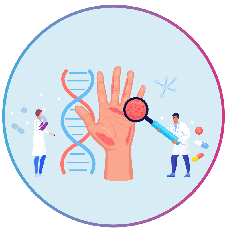 Personalized Psoriasis Treatment: A Case Study On How AI Accelerated Biomarker Discovery